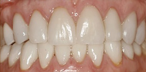 dental images 11978